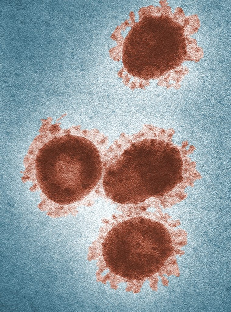 Virus under a microscope